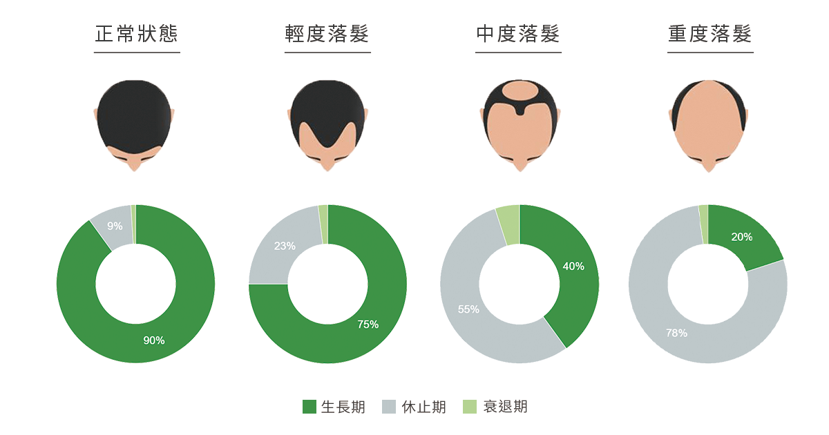男性掉髮分期