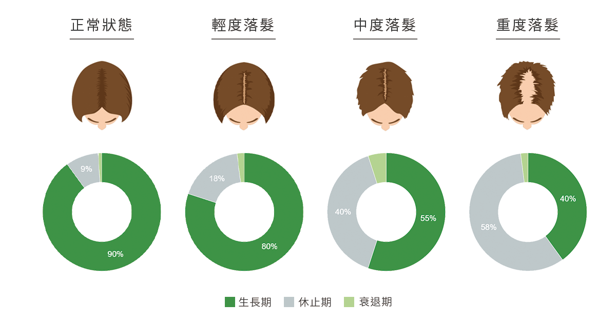 女性掉髮分期