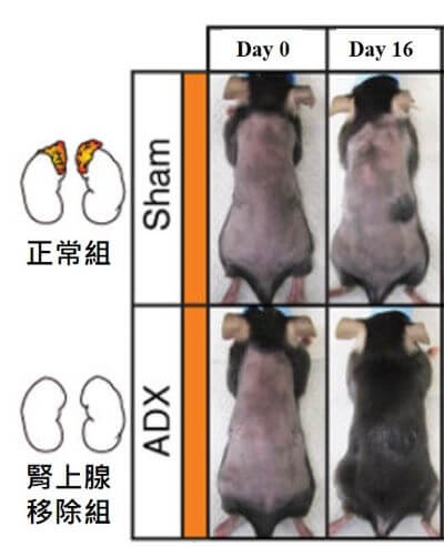 壓力激素會影響毛髮生長之速度